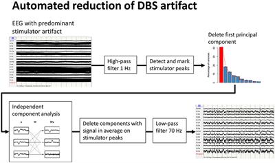 Quantitative EEG and Verbal Fluency in DBS Patients: Comparison of Stimulator-On and -Off Conditions